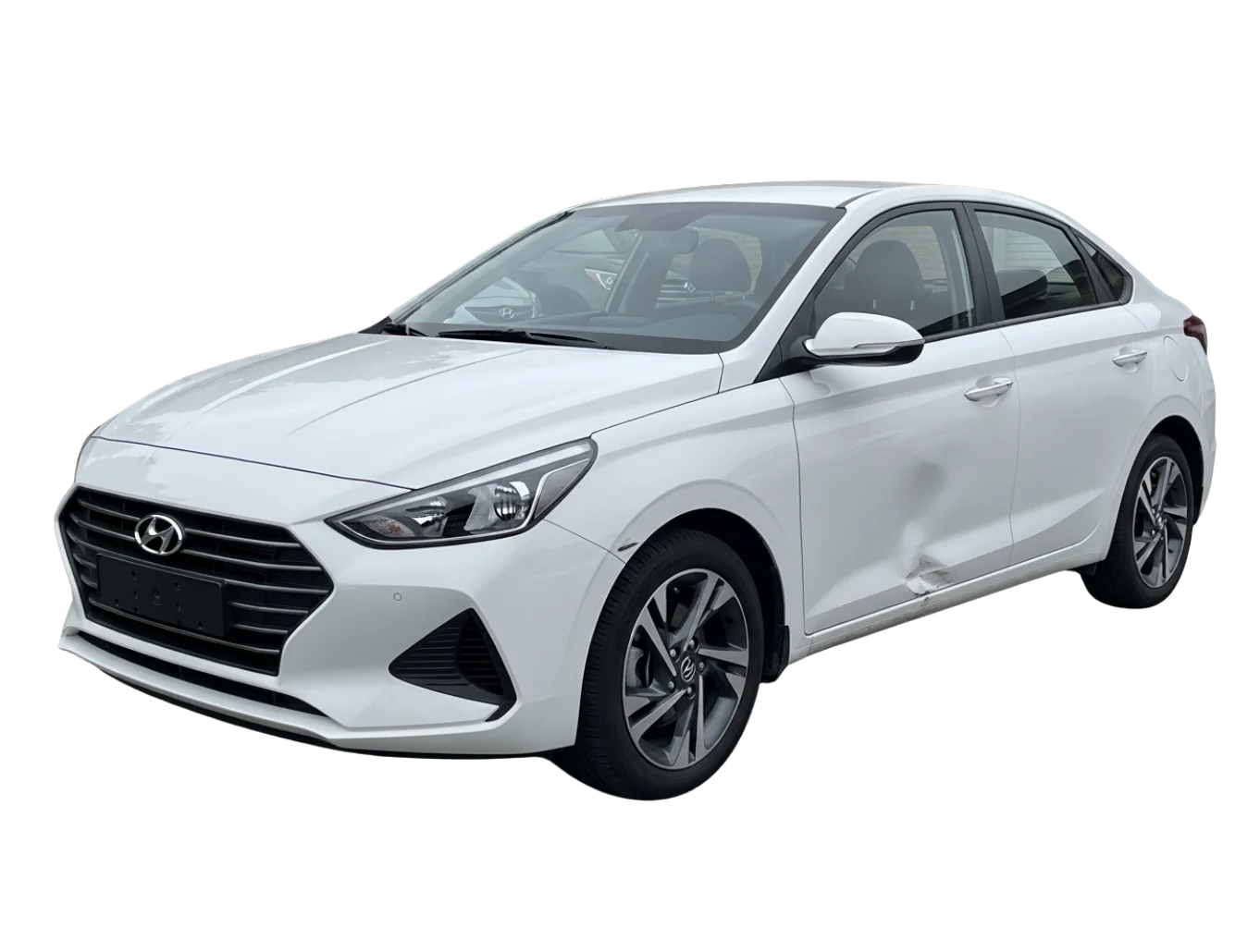 Hyundai Dent Repair